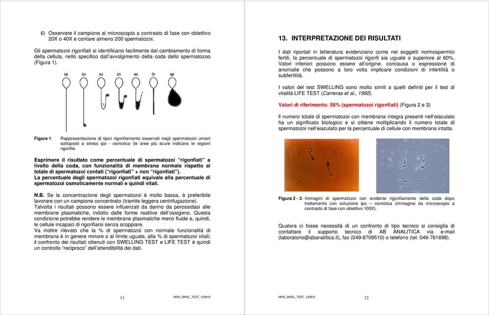 INTERPRETAZIONE DEI RISULTATI I dati riportati in letteratura evidenziano come nei soggetti normospermici fertili, la percentuale di spermatozoi rigonfi sia uguale o superiore al 60%.