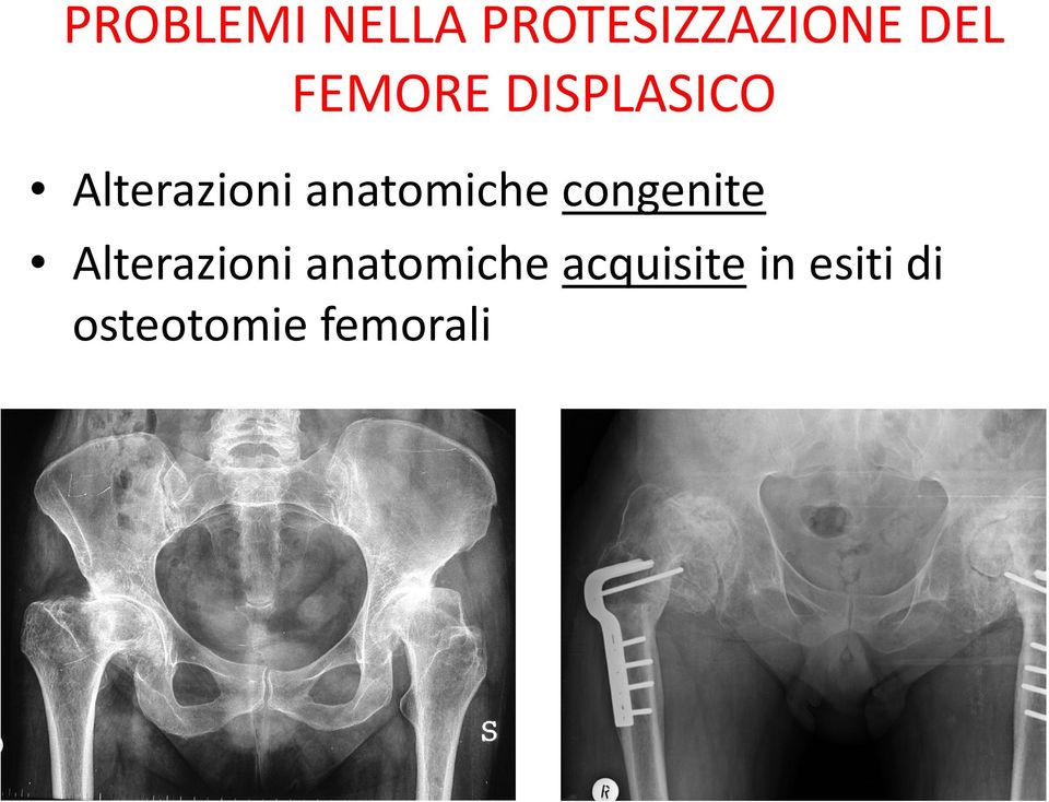 anatomiche congenite Alterazioni