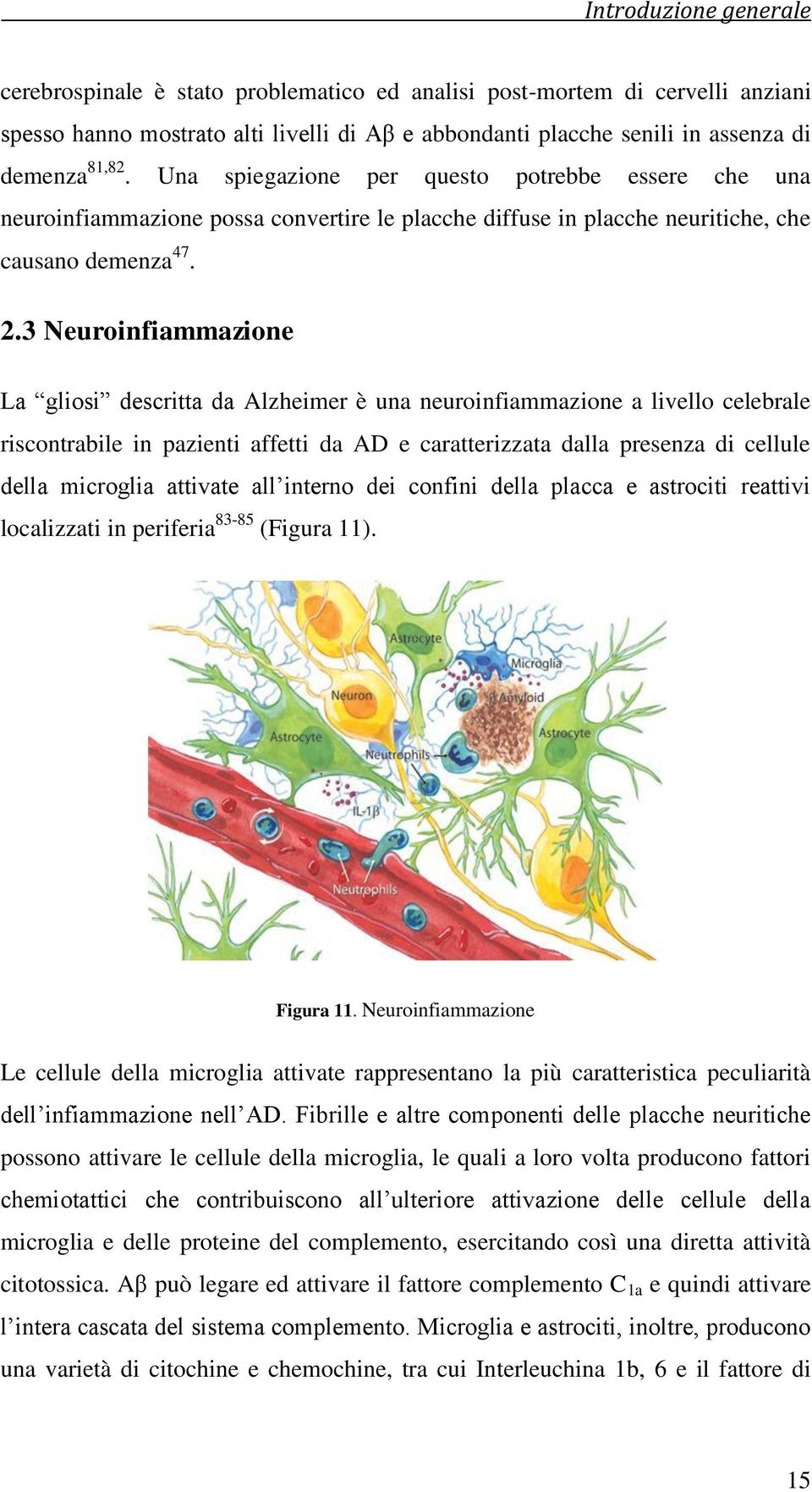 3 euroinfiammazione La gliosi descritta da Alzheimer è una neuroinfiammazione a livello celebrale riscontrabile in pazienti affetti da AD e caratterizzata dalla presenza di cellule della microglia