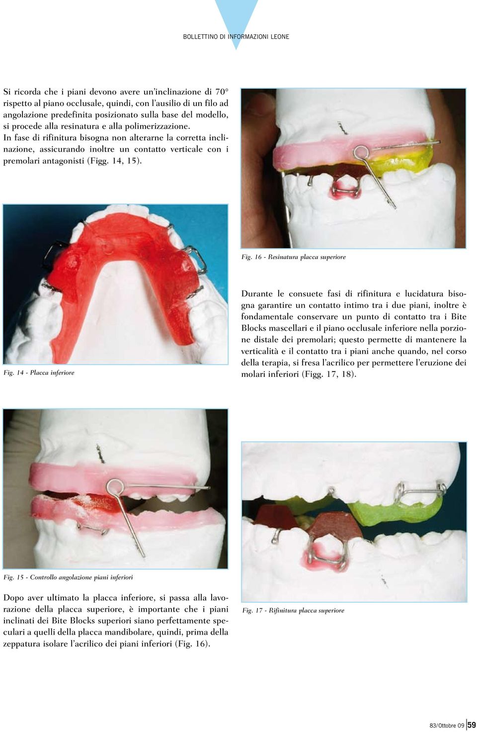 16 - Resinatura placca superiore Fig.