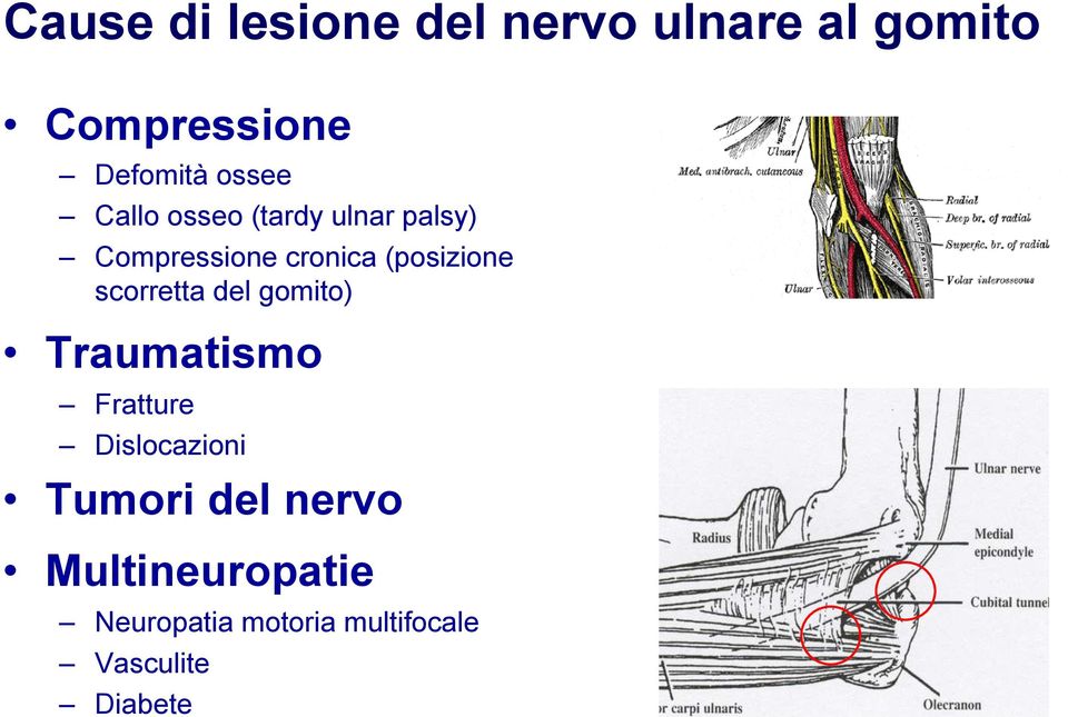 (posizione scorretta del gomito) Traumatismo Fratture Dislocazioni