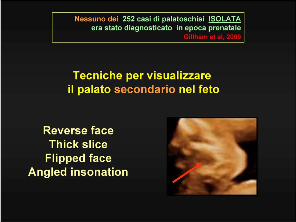 Tecniche per visualizzare il palato secondario nel