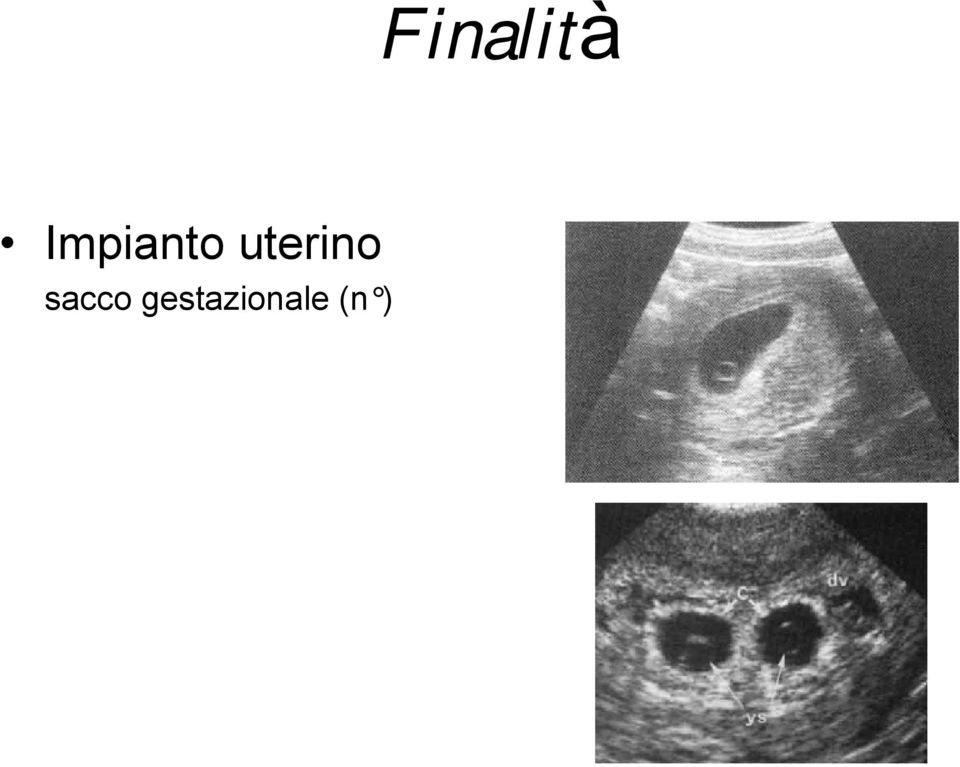 uterino