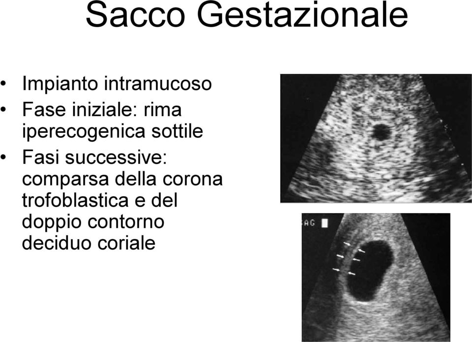 Fasi successive: comparsa della corona