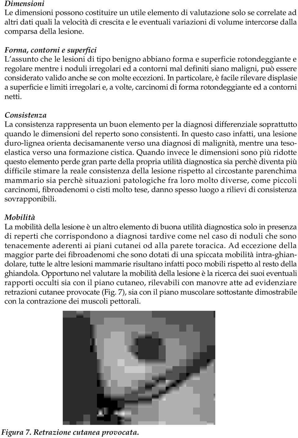 Forma, contorni e superfici L assunto che le lesioni di tipo benigno abbiano forma e superficie rotondeggiante e regolare mentre i noduli irregolari ed a contorni mal definiti siano maligni, può