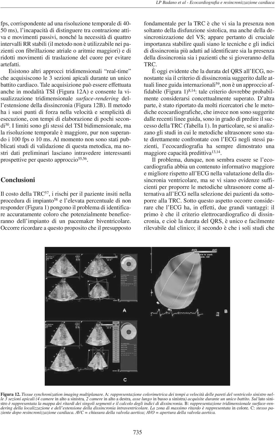 evitare artefatti. Esistono altri approcci tridimensionali real-time che acquisiscono le 3 sezioni apicali durante un unico battito cardiaco.