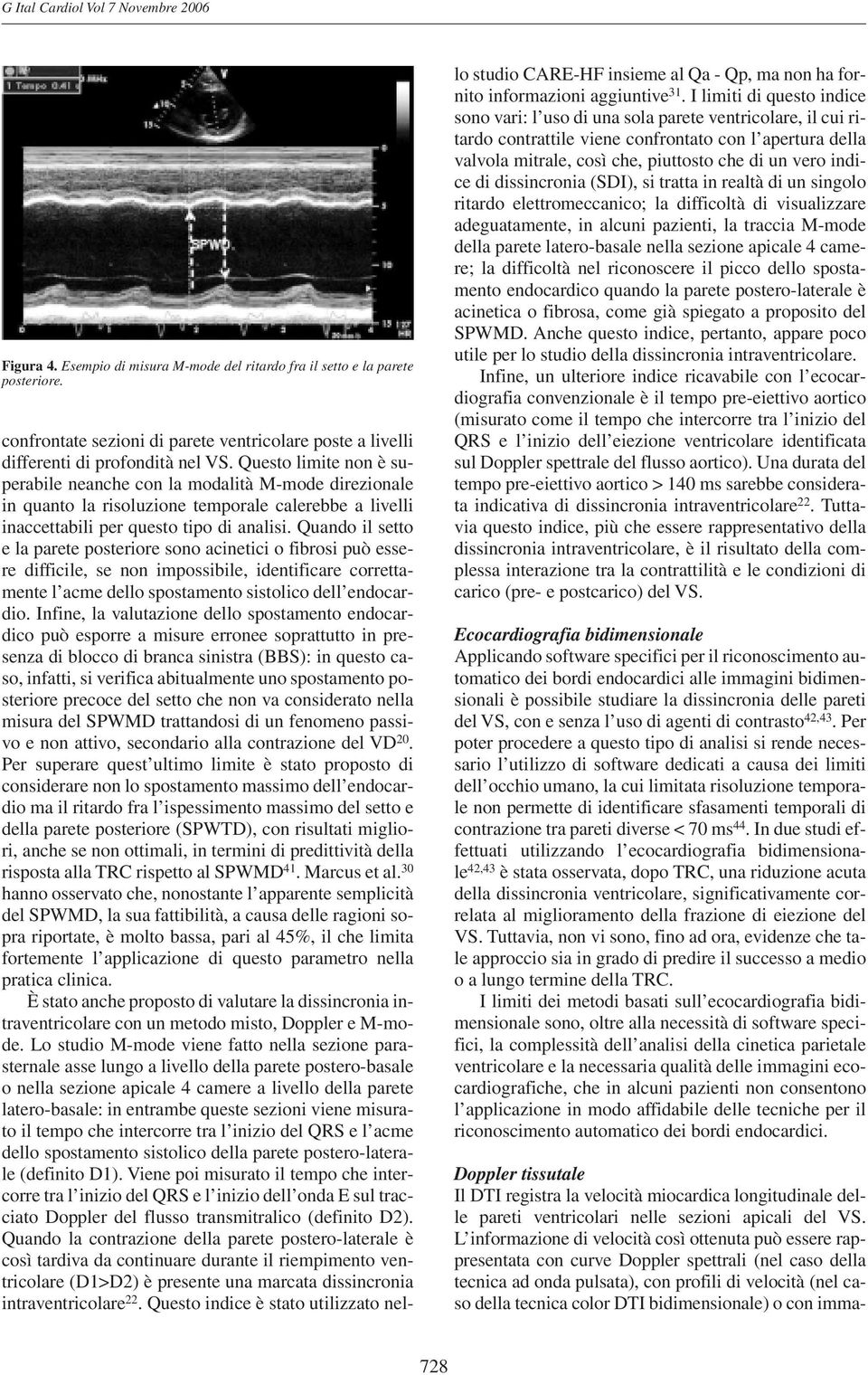 Questo limite non è superabile neanche con la modalità M-mode direzionale in quanto la risoluzione temporale calerebbe a livelli inaccettabili per questo tipo di analisi.