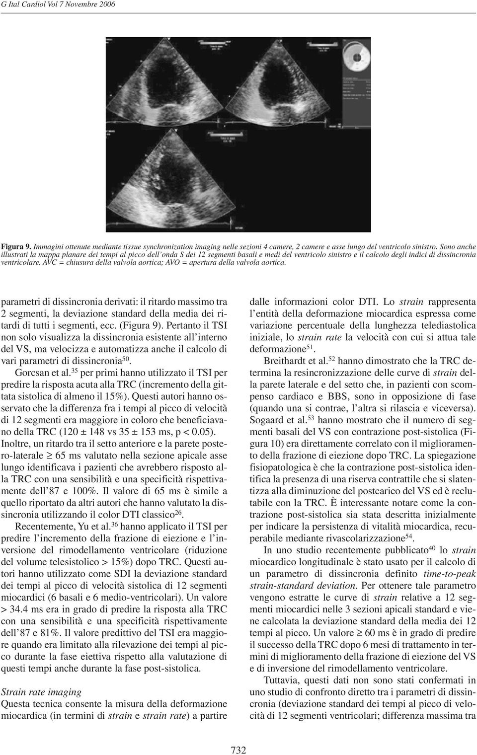 AVC = chiusura della valvola aortica; AVO = apertura della valvola aortica.