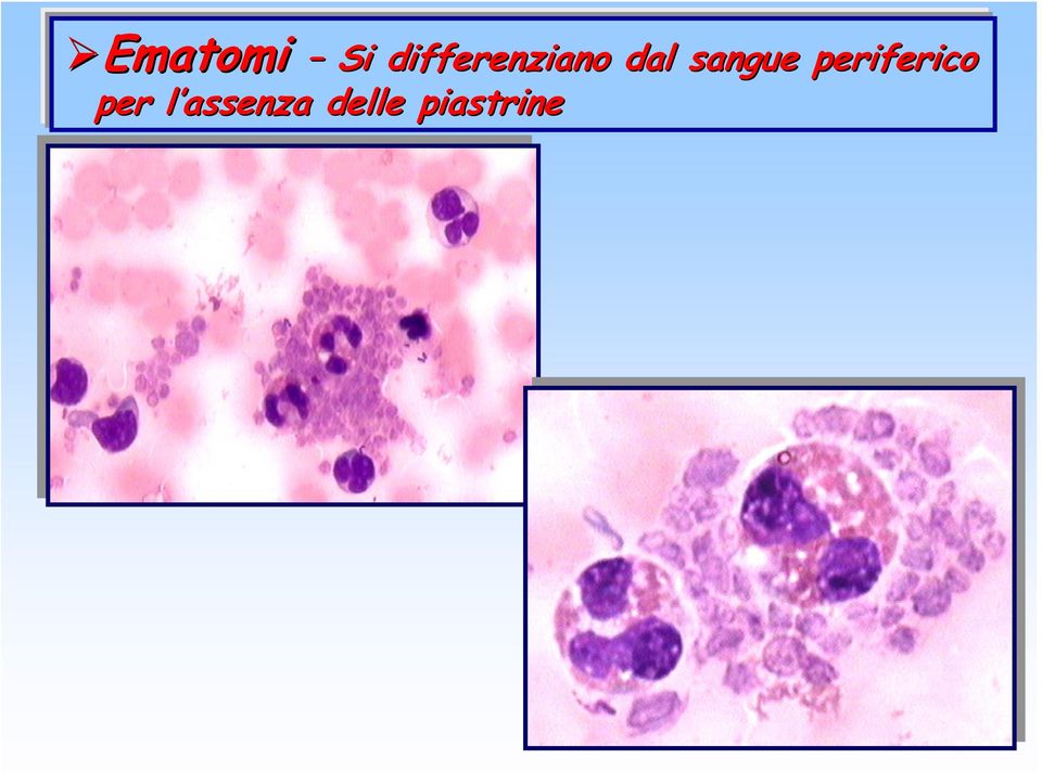 sangue periferico