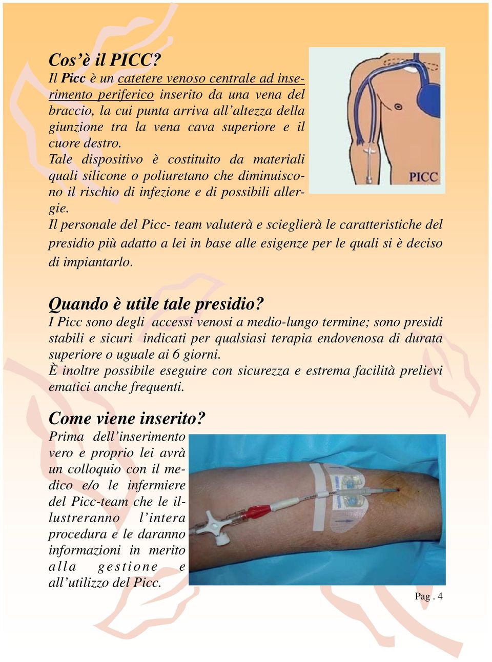 Tale dispositivo è costituito da materiali quali silicone o poliuretano che diminuiscono il rischio di infezione e di possibili allergie.