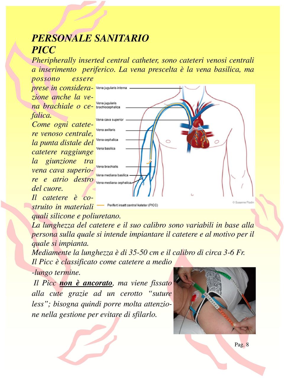 Come ogni catetere venoso centrale, la punta distale del catetere raggiunge la giunzione tra vena cava superiore e atrio destro del cuore.