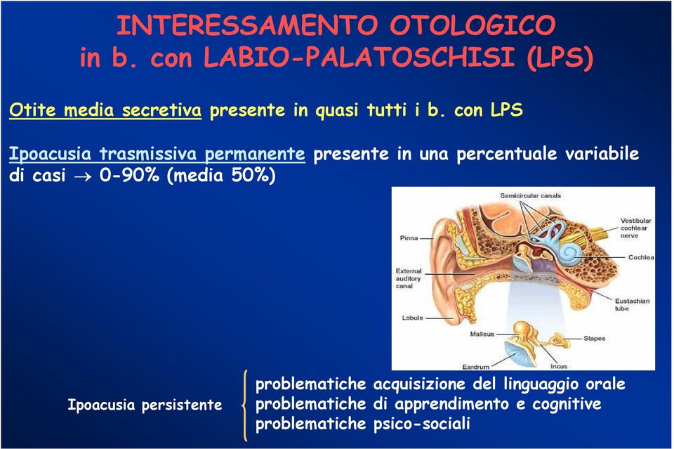 con LPS Ipoacusia trasmissiva permanente presente in una percentuale variabile di casi