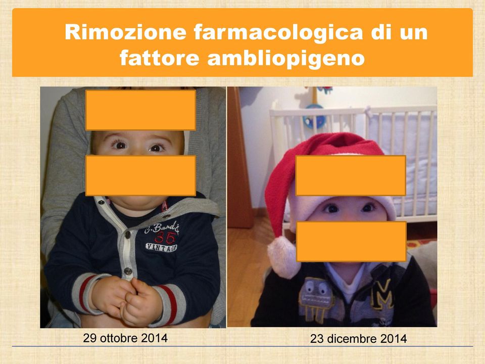 fattore ambliopigeno