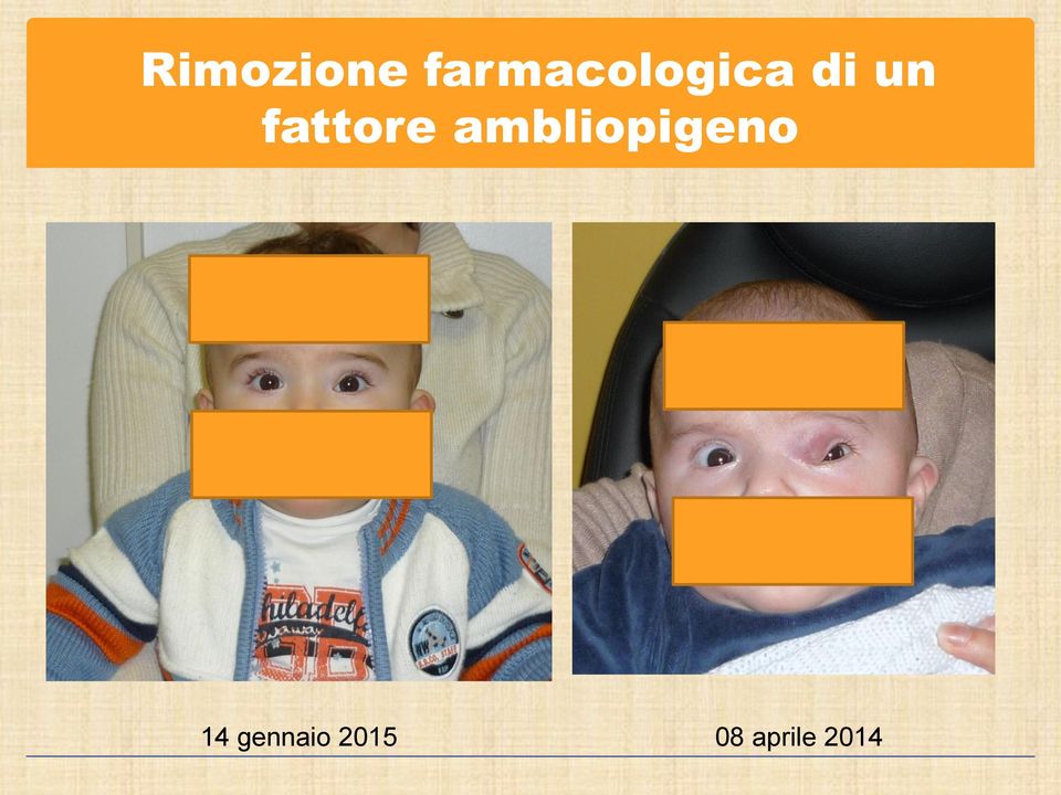 fattore ambliopigeno