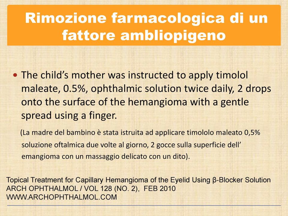 (La madre del bambino è stata istruita ad applicare timololo maleato 0,5% soluzione oftalmica due volte al giorno, 2 gocce sulla superficie