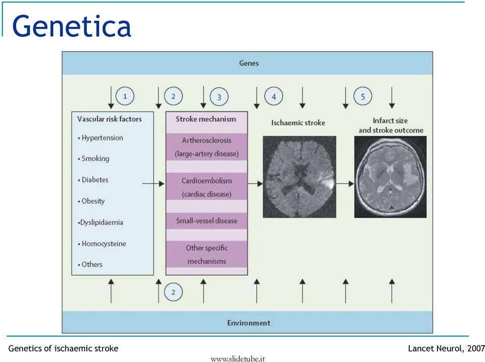 ischaemic