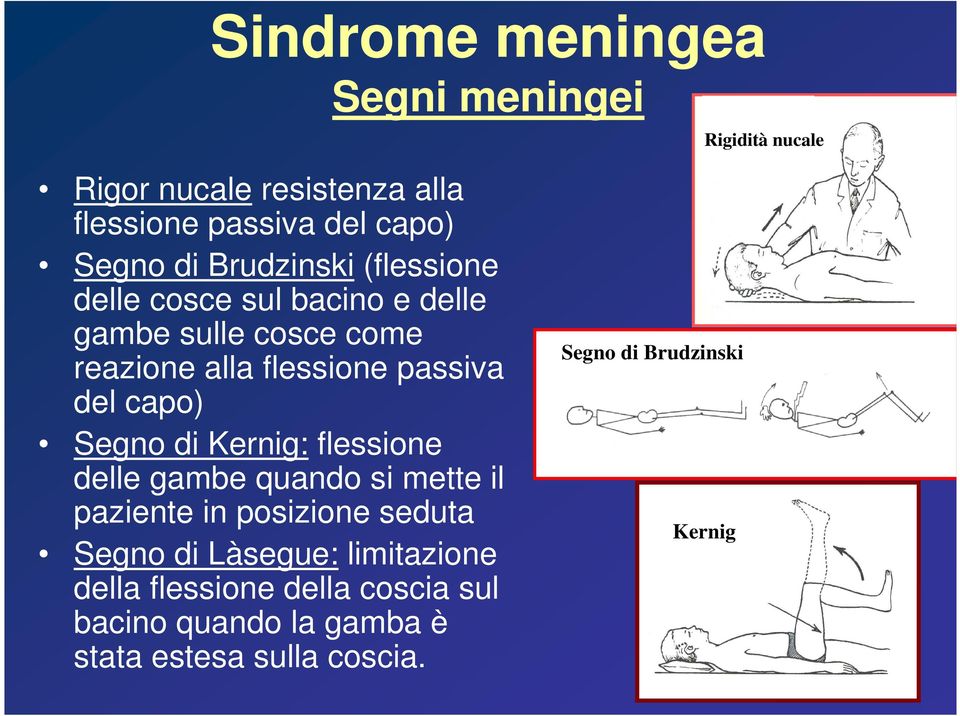 capo) Segno di Kernig: flessione delle gambe quando si mette il paziente in posizione seduta Segno di Làsegue: