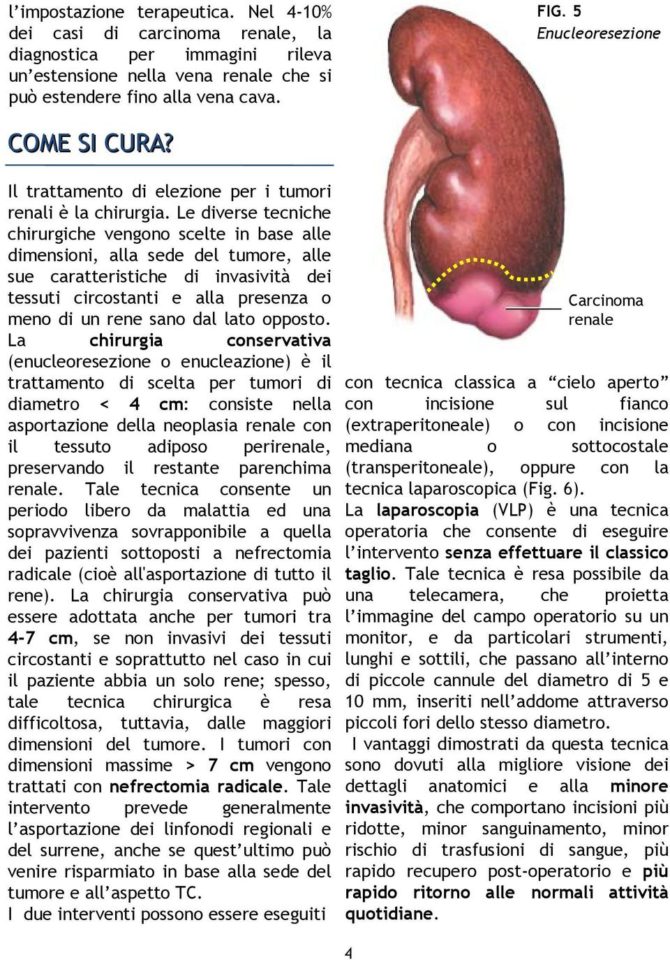 Le diverse tecniche chirurgiche vengono scelte in base alle dimensioni, alla sede del tumore, alle sue caratteristiche di invasività dei tessuti circostanti e alla presenza o meno di un rene sano dal