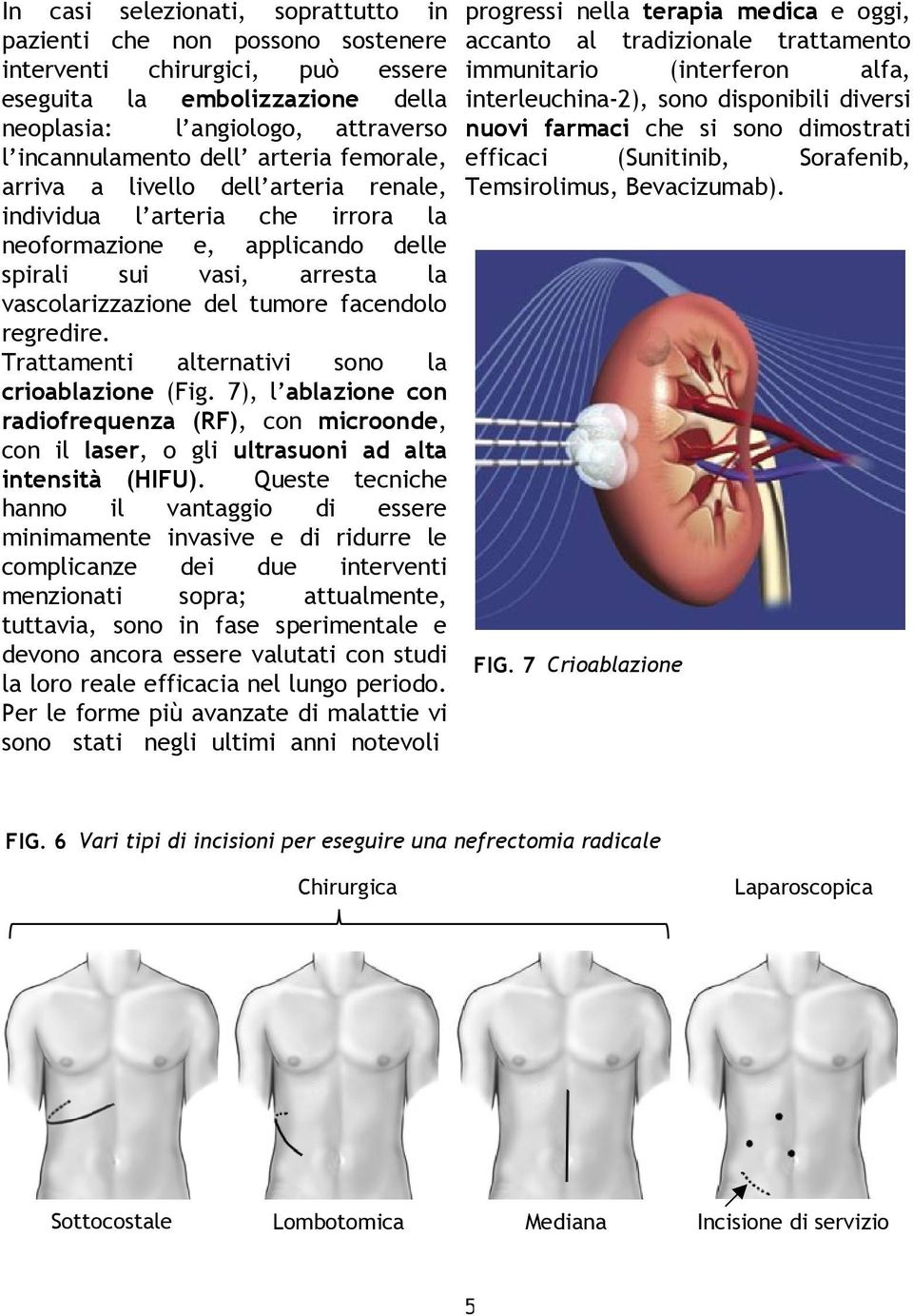 Trattamenti alternativi sono la crioablazione (Fig. 7), l ablazione con radiofrequenza (RF), con microonde, con il laser, o gli ultrasuoni ad alta intensità (HIFU).