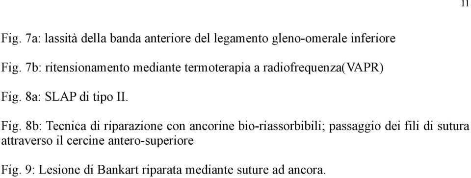 Fig. 8b: Tecnica di riparazione con ancorine bio-riassorbibili; passaggio dei fili di sutura