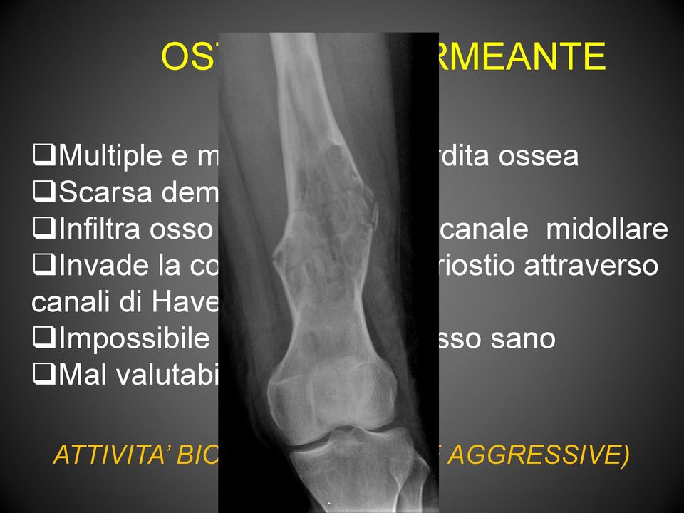 corticale fino al periostio attraverso canali di Havers e Volkmann