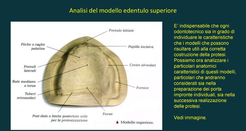 Possiamo ora analizzare i particolari anatomici caratteristici di questi modelli, particolari che andranno