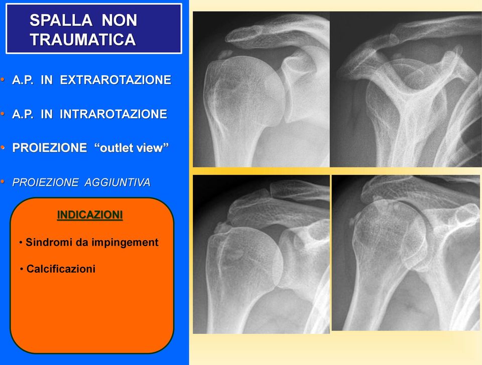 view PROIEZIONE AGGIUNTIVA INDICAZIONI