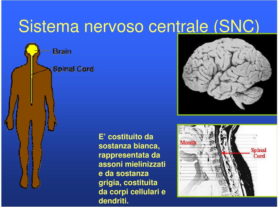 rappresentata da assoni mielinizzati e