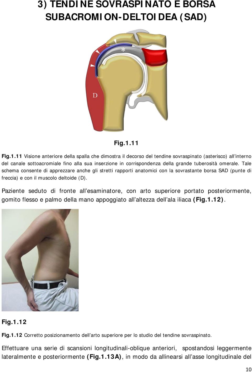 tuberosità omerale. Tale schema consente di apprezzare anche gli stretti rapporti anatomici con la sovrastante borsa SAD (punte di freccia) e con il muscolo deltoide (D).