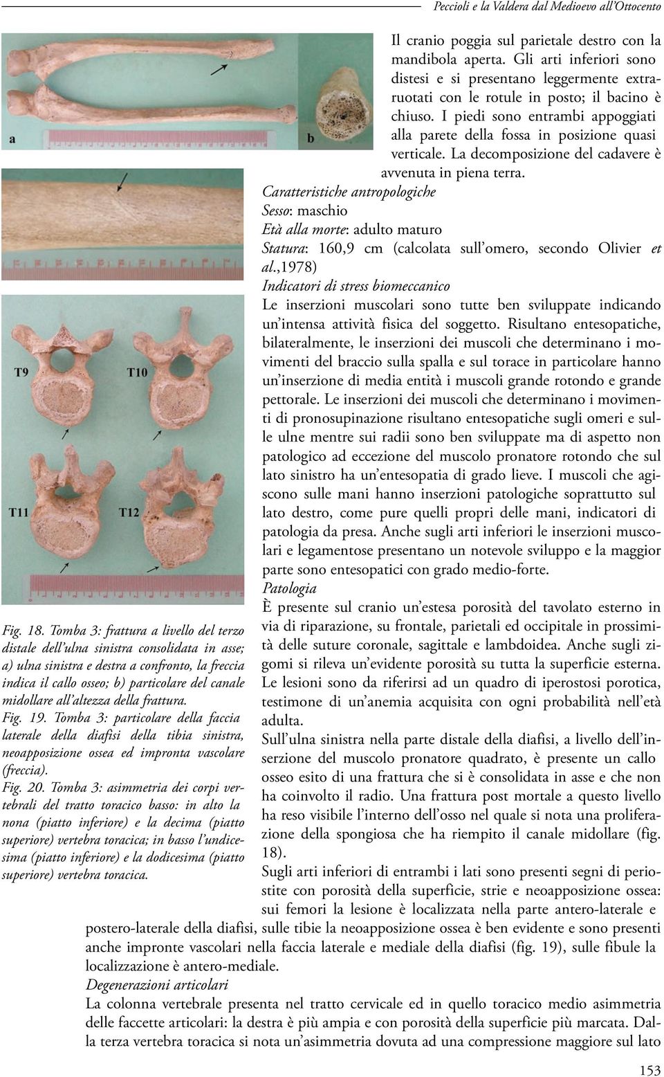 I piedi sono entrambi appoggiati alla parete della fossa in posizione quasi verticale. La decomposizione del cadavere è avvenuta in piena terra.