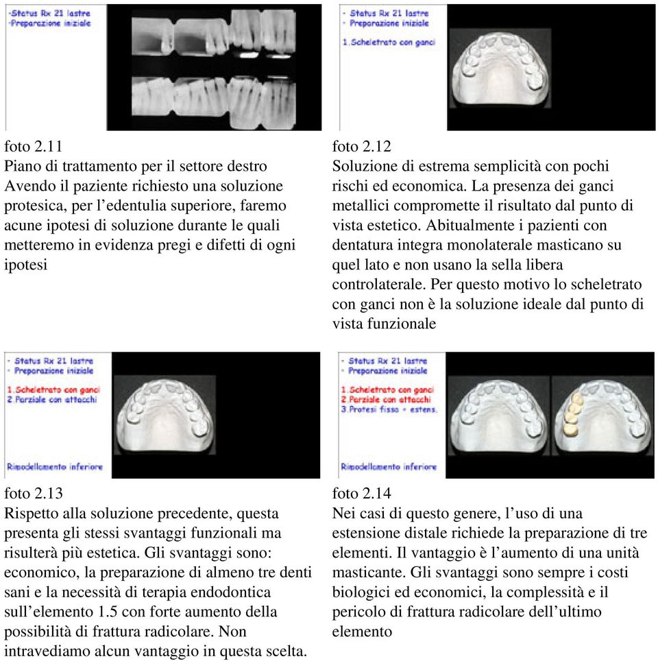 pregi e difetti di ogni ipotesi 12 Soluzione di estrema semplicità con pochi rischi ed economica. La presenza dei ganci metallici compromette il risultato dal punto di vista estetico.