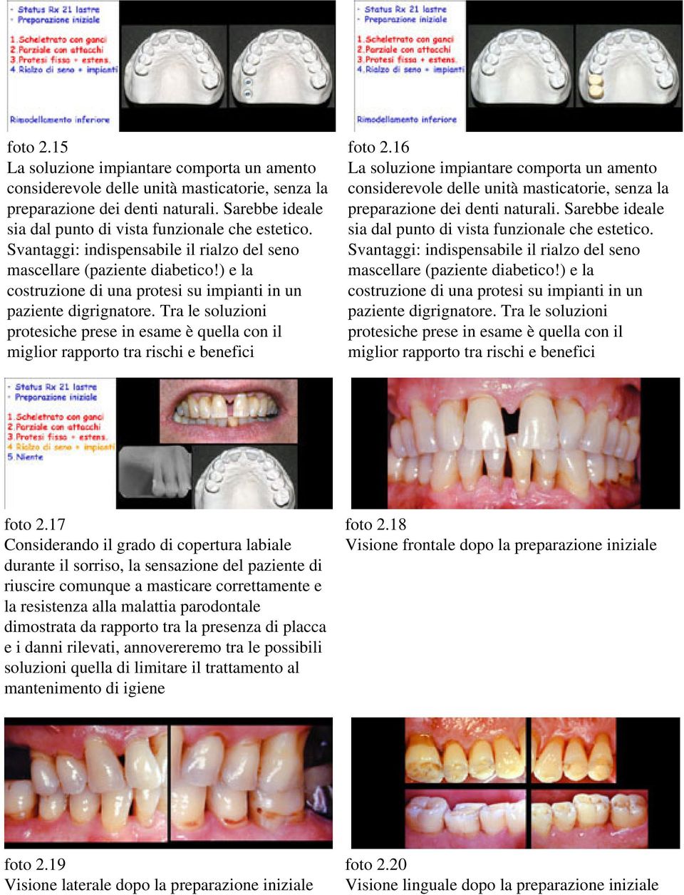 Tra le soluzioni protesiche prese in esame è quella con il miglior rapporto tra rischi e benefici foto 2.