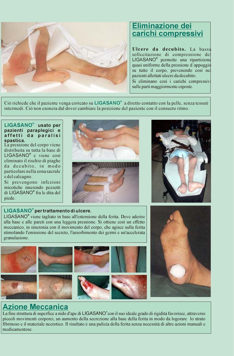 Si eliminano cosí i carichi compressivi sulle parti maggiormente esposte. Ció richiede che il paziente venga coricato su a diretto contatto con la pelle, senza tessuti intermedi.