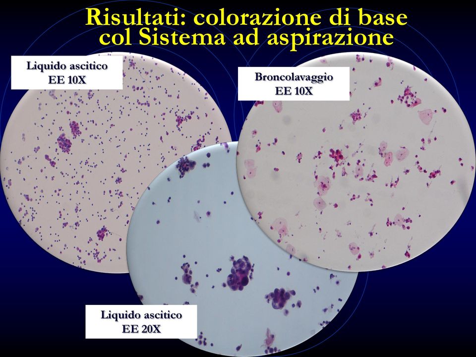 col Sistema ad aspirazione