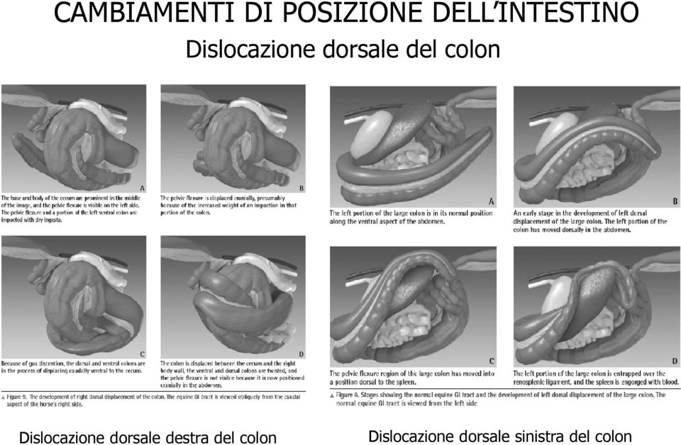 colon Dislocazione dorsale destra