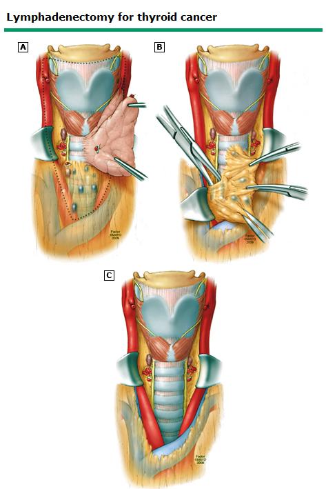 Mastery of Surgery, Fischer, JE, Bland, KI, Callery, MP