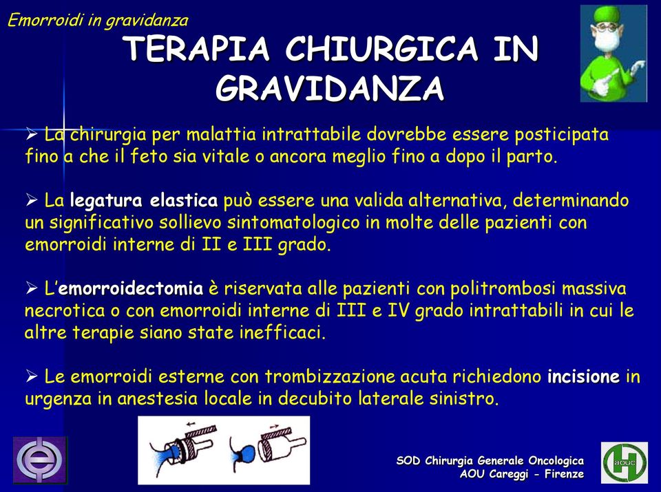 La legatura elastica può essere una valida alternativa, determinando un significativo sollievo sintomatologico in molte delle pazienti con emorroidi interne di II