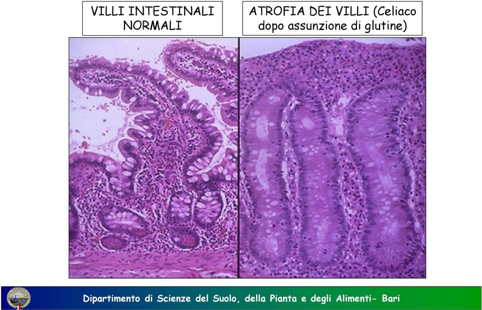 VILLI (Celiaco dopo