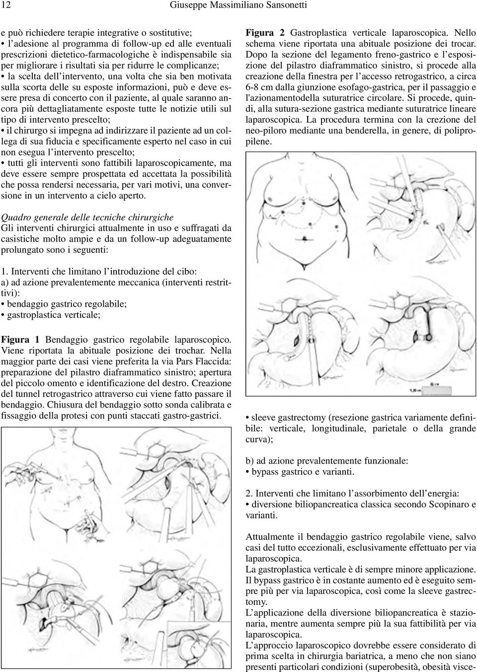 L applicazione della diversione biliopancreatica è stazionaria, mentre aumenta sempre più la sua fattibilità per via laparoscopica.