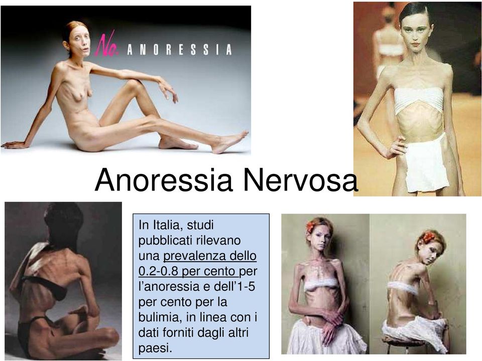 8 per cento per l anoressia e dell 1-5 per cento