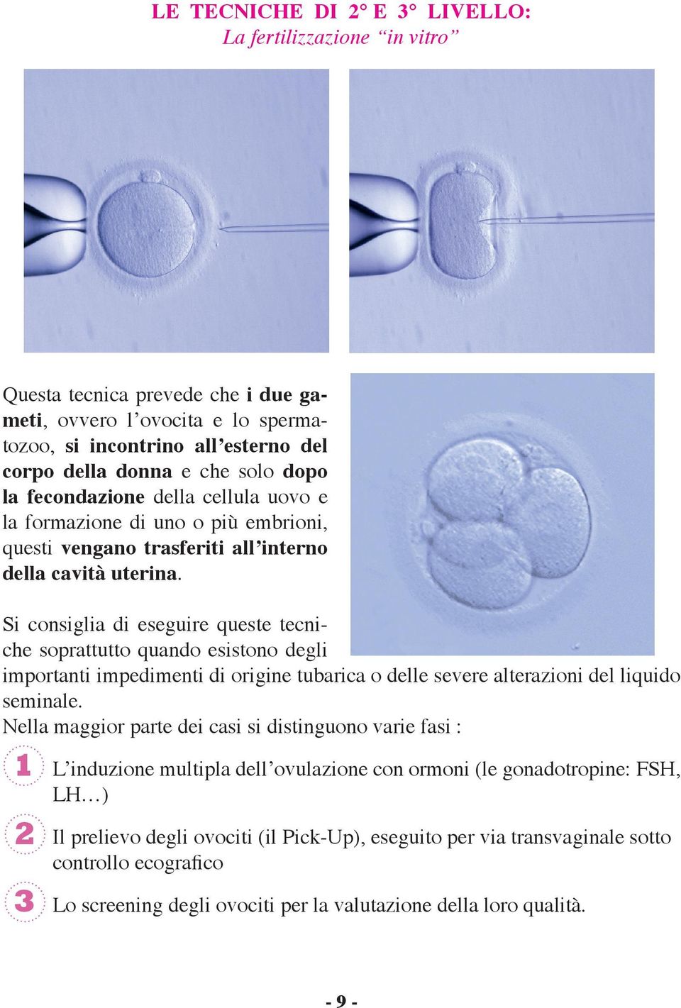 Si consiglia di eseguire queste tecniche soprattutto quando esistono degli importanti impedimenti di origine tubarica o delle severe alterazioni del liquido seminale.