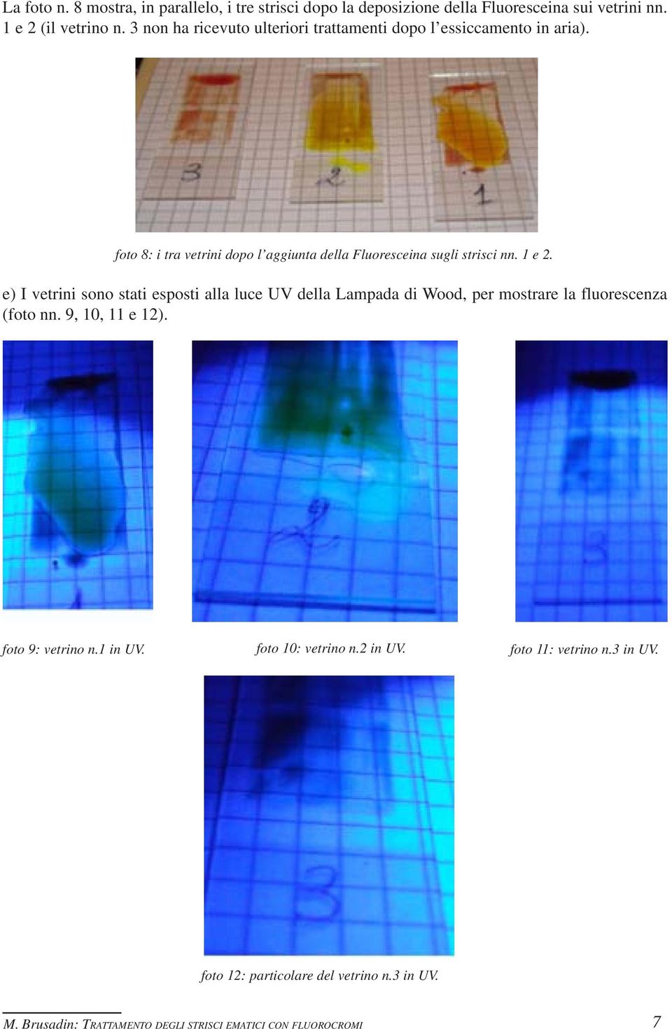 foto 8: i tra vetrini dopo l aggiunta della Fluoresceina sugli strisci nn. 1 e 2.