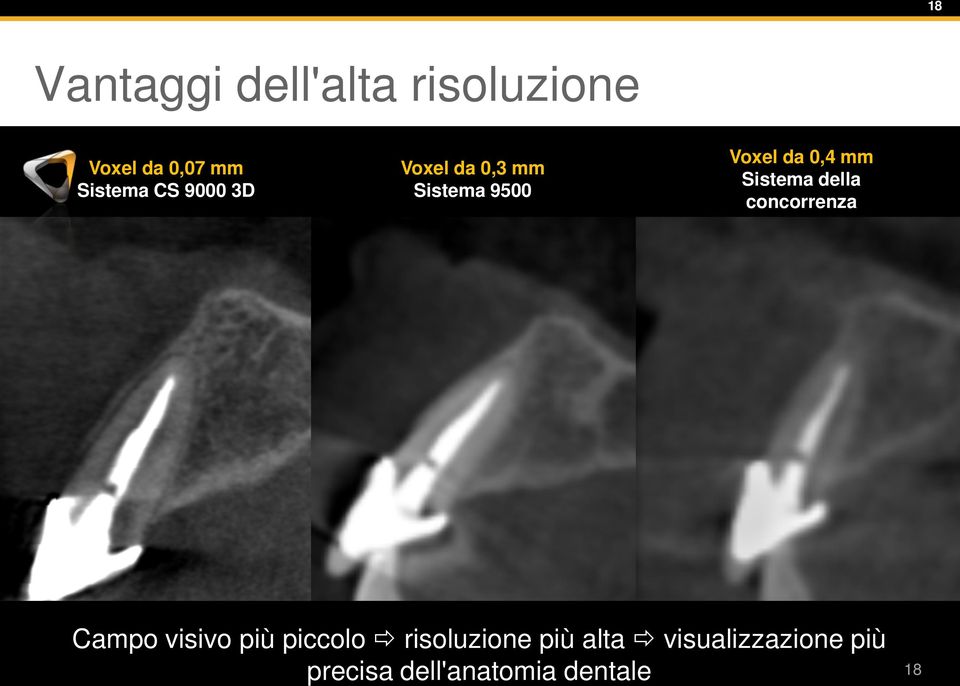 Sistema della concorrenza Campo visivo più piccolo