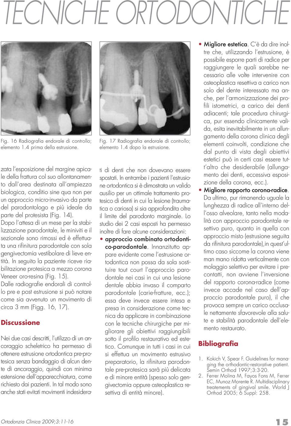 parodontologo e più ideale da parte del protesista (Fig. 14).