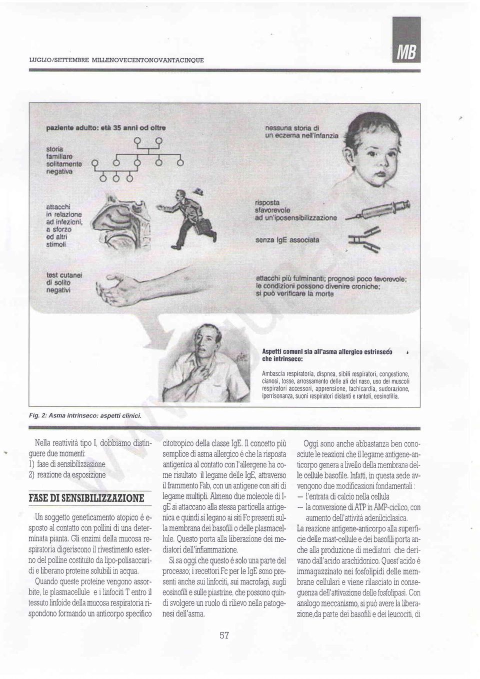 del naso, uso dei muscoli respiratori access0ri, apprensione, tachicardia, sudorazione, iperrisonanza, suoni respiratori distanti e rant0li, e0sin0filia Fig. 2: Asma intrinseco: aspetti clinici.