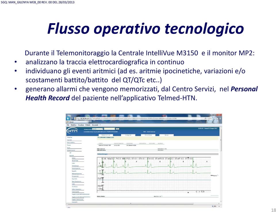 aritmie ipocinetiche, variazioni e/o scostamenti battito/battito del QT/QTcetc.