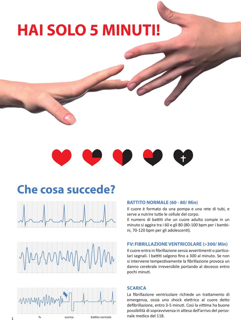 FV: FIBRILLAZIONE VENTRICOLARE (>300/ Min) Il cuore entra in ﬁbrillazione senza avvertimenti o particolari segnali. I battiti salgono ﬁno a 300 al minuto.