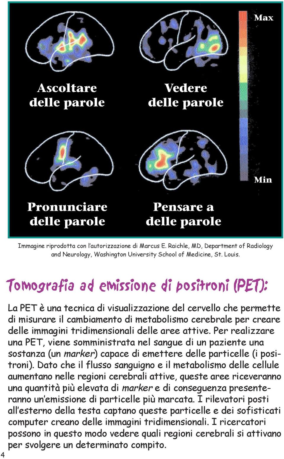 4 Tomografia ad emissione di positroni (PET): La PET è una tecnica di visualizzazione del cervello che permette di misurare il cambiamento di metabolismo cerebrale per creare delle immagini