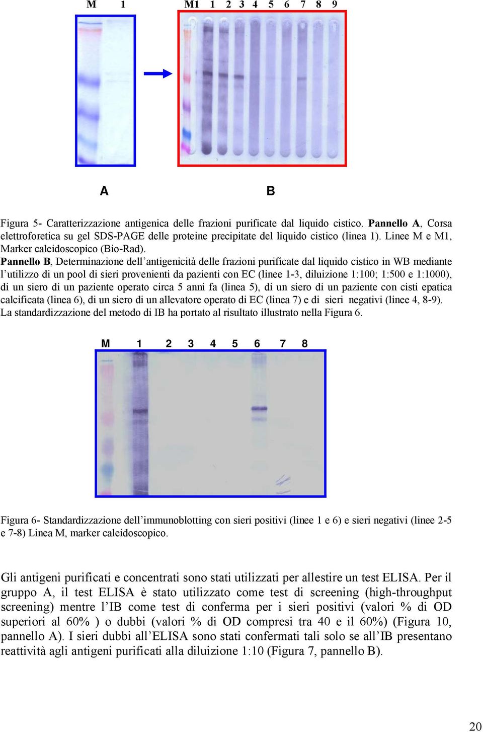 Pannello B, Determinazione dell antigenicità delle frazioni purificate dal liquido cistico in WB mediante l utilizzo di un pool di sieri provenienti da pazienti con EC (linee 1-3, diluizione 1:100;