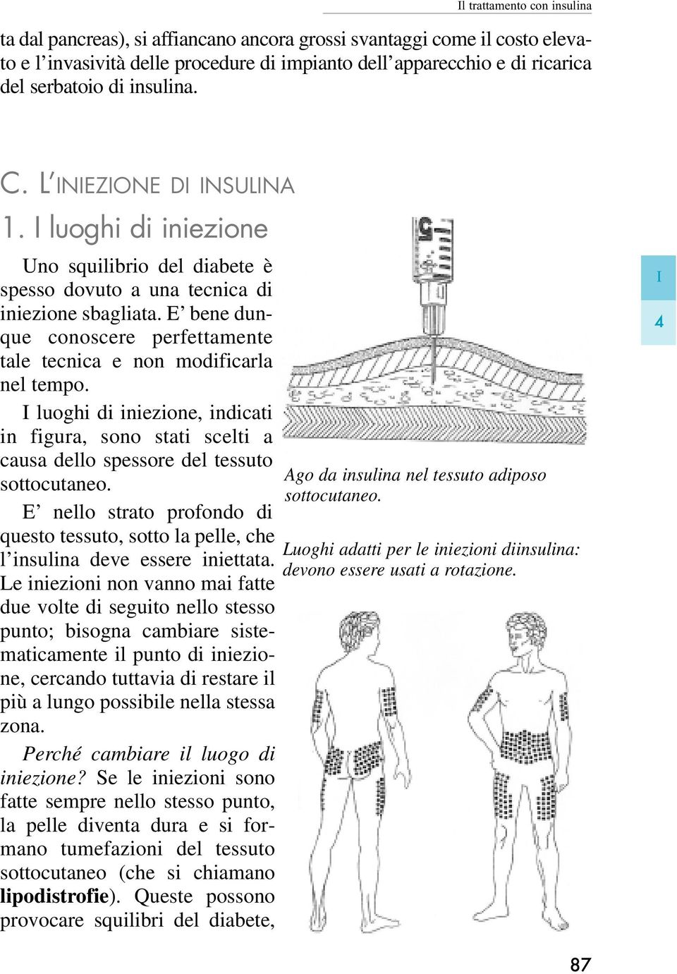 E bene dunque conoscere perfettamente tale tecnica e non modificarla nel tempo. I luoghi di iniezione, indicati in figura, sono stati scelti a causa dello spessore del tessuto sottocutaneo.